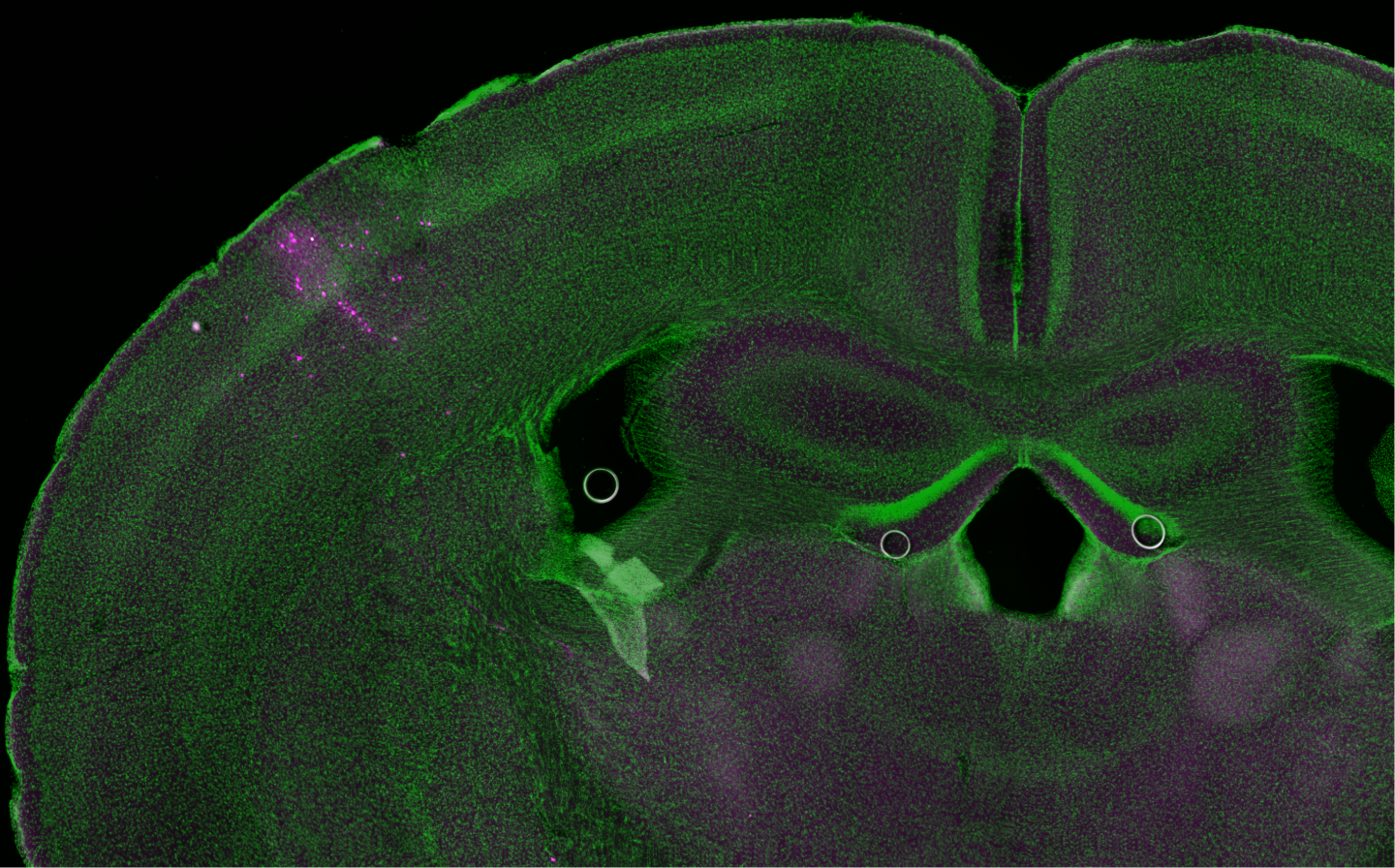 brain section