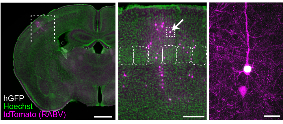 sparse monosynaptic rabies tracing