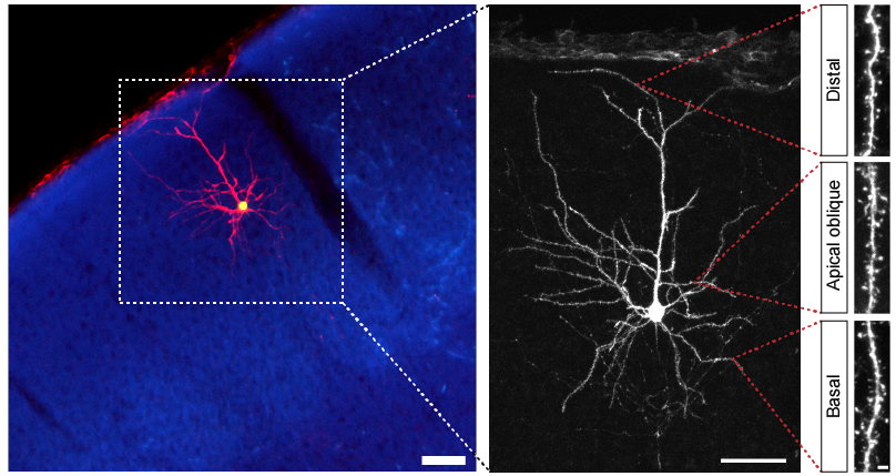 labeling of individual cortical neuron
