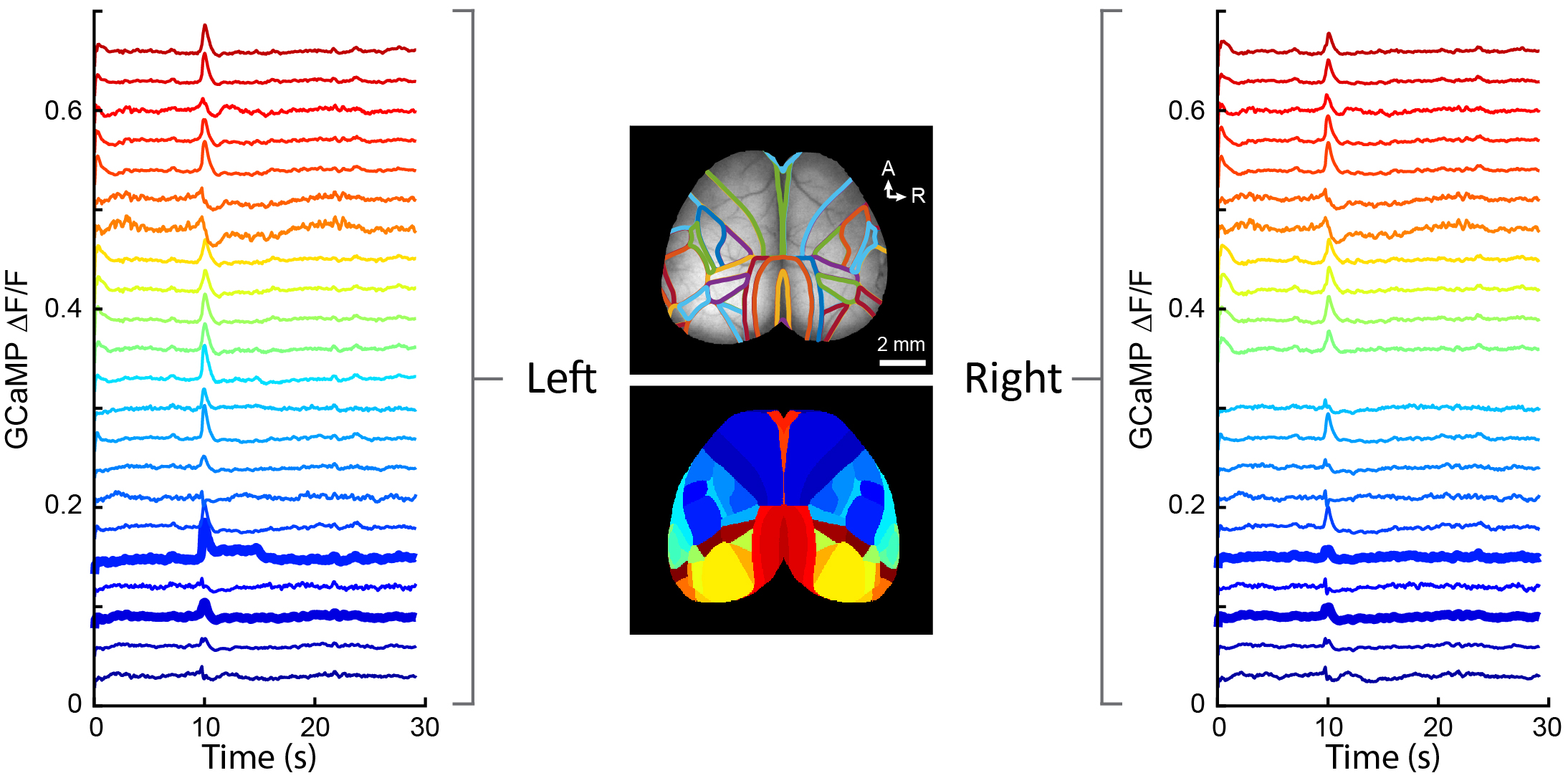 parcellation of cortex